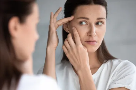 Women experiencing improved acne-prone skin with Sébium serum.