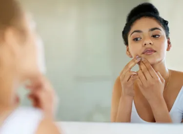 Woman with acne-prone skin looking in a mirror
